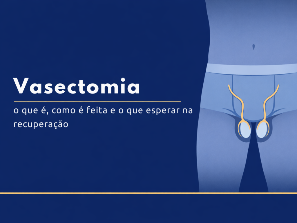 ilustração anatômica mostrando o ducto deferente na vasectomia
